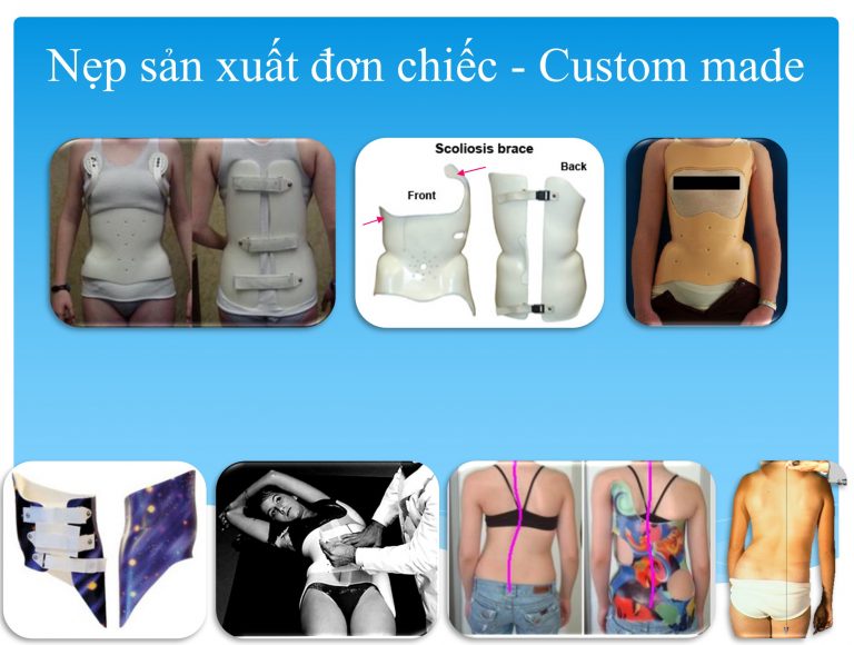 Áo nẹp chỉnh hình cột sống 3D (vẹo cột sống)