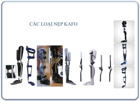 Nẹp gối – cổ chân – bàn chân (KAFO) & nẹp hông (HKAFO)
