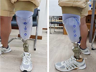 Hệ thống socket áp lực âm chủ động