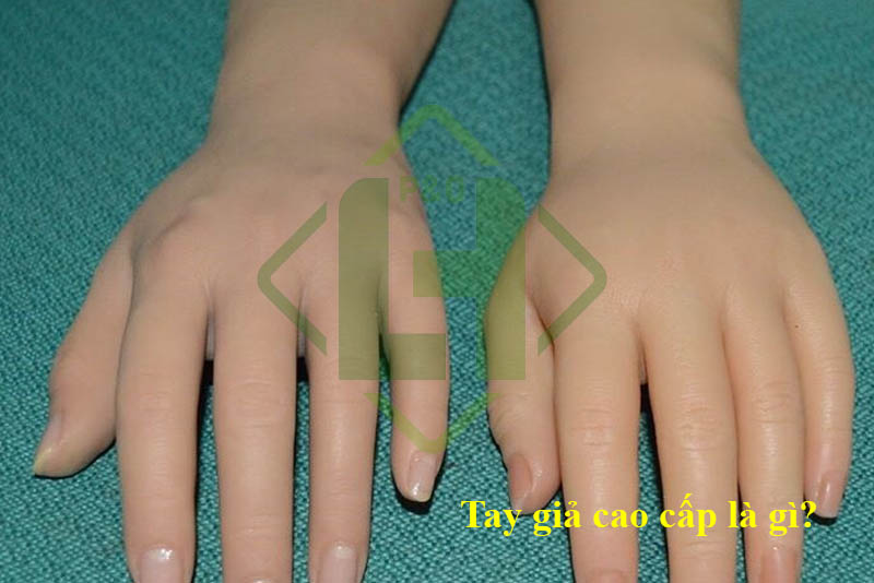 Tay giả chức năng & thẩm mỹ